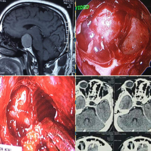 brain-surgeon-in-thane