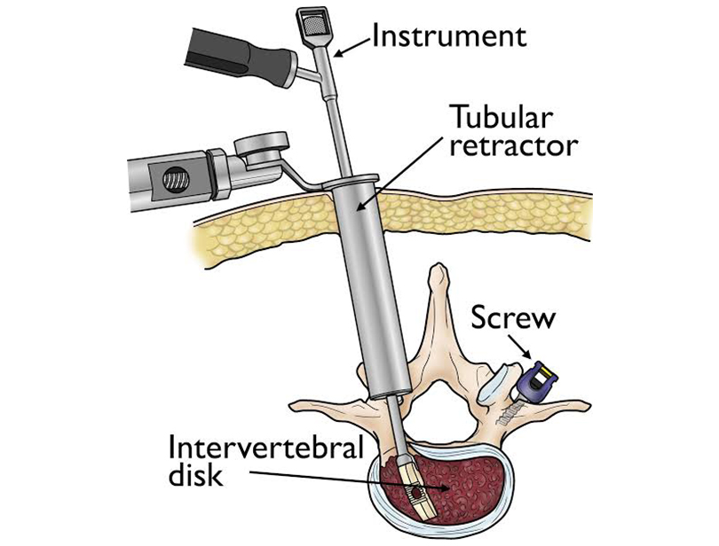 Neuro-Surgeon-in-Ghodbunder-Road